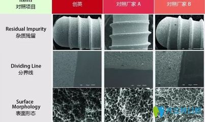 國產(chǎn)種植牙系統(tǒng)新星 創(chuàng)英種植牙系統(tǒng)的優(yōu)勢與研究所技術(shù)實(shí)力解析